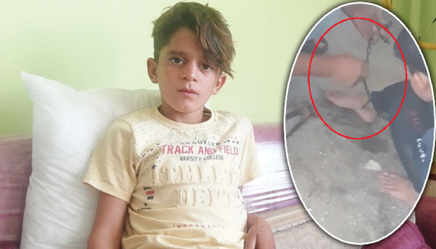 Yangında zincire bağlı bulunmuştu Bakanlıktan açıklama geldi