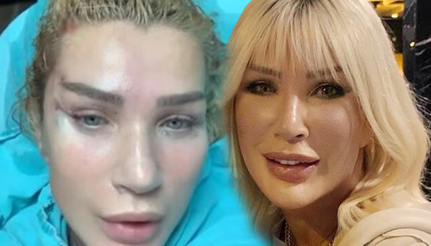 İşte Seda Sayanın son hali Yüz gerildi, imaj yenilendi...