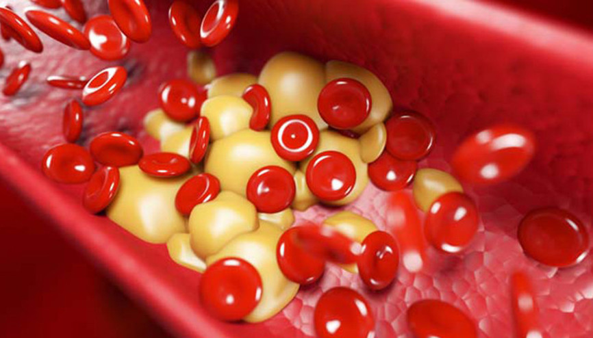 Salgın sürecinde korku ve hareketsizlik, pıhtı atımını artırdı Salgın sürecinde korku ve hareketsizlik, pıhtı atımını artırdı