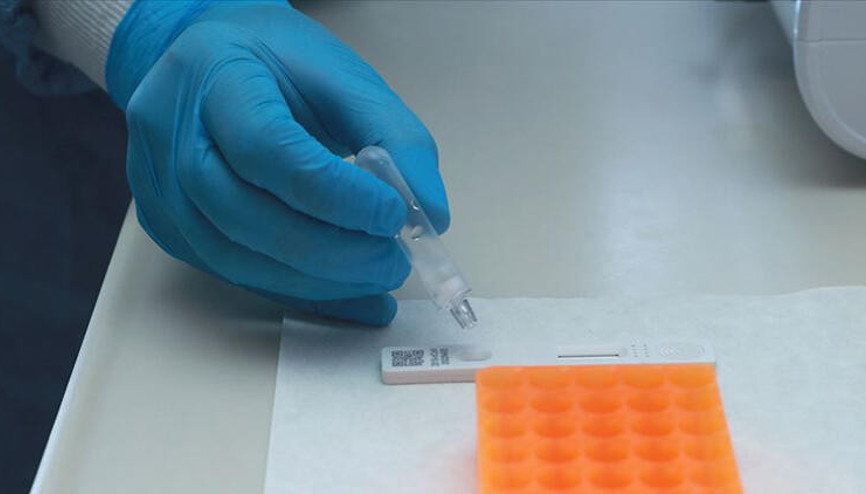 Kovid ve grip testi aynı anda yapılarak grip salgınında da yol haritası çizilecek