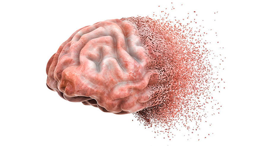 Alzheimer Sadece Yaşlılık İle Olmuyor İşte Sebepleri...