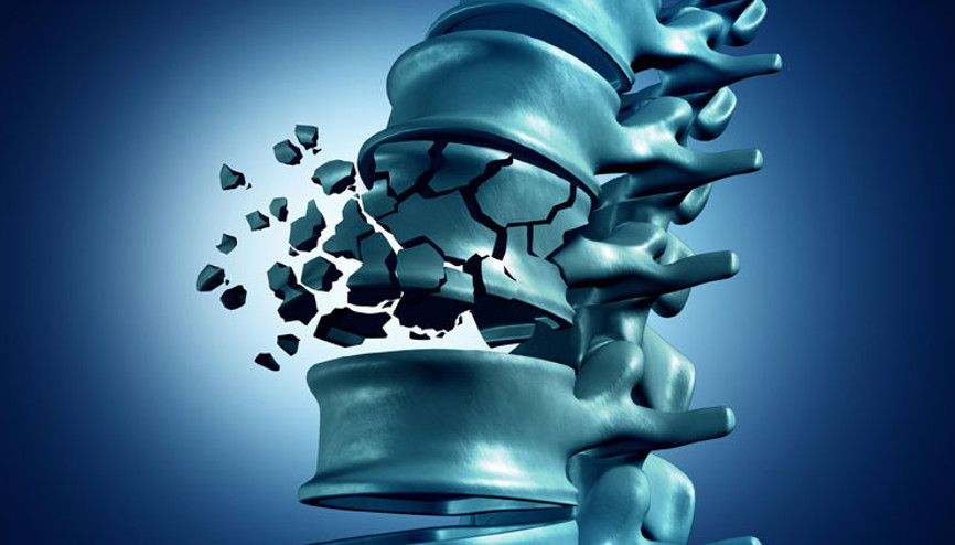 Güçlü kemikler sağlıklı yarınlar