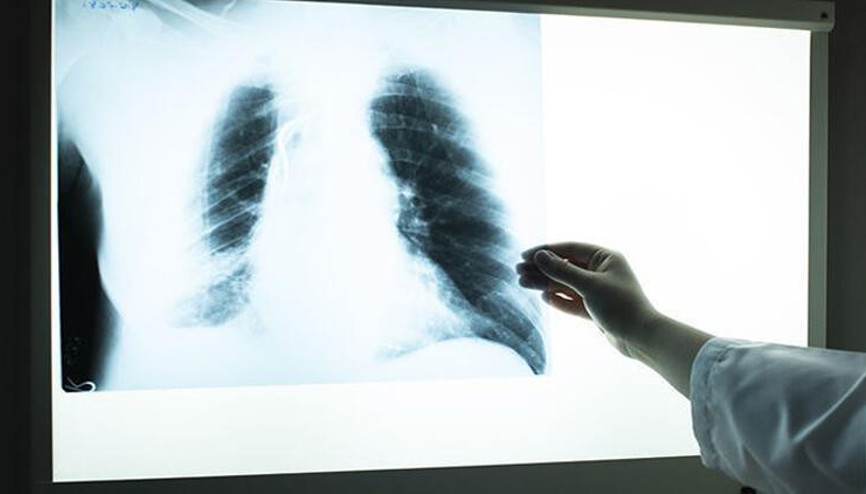 Türk mühendis, röntgen filmlerinden koronayı teşhis eden sistem geliştirdi