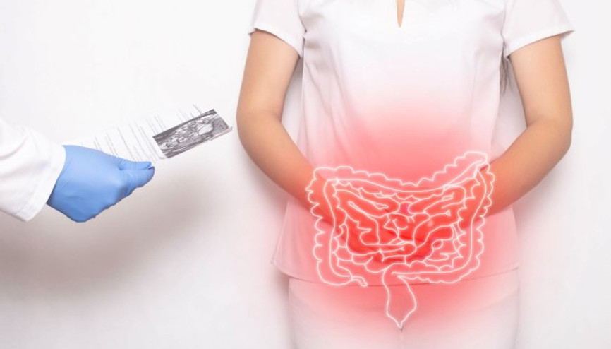 Kolon Kanserinin Bu Bulgularını Ciddiye Alın