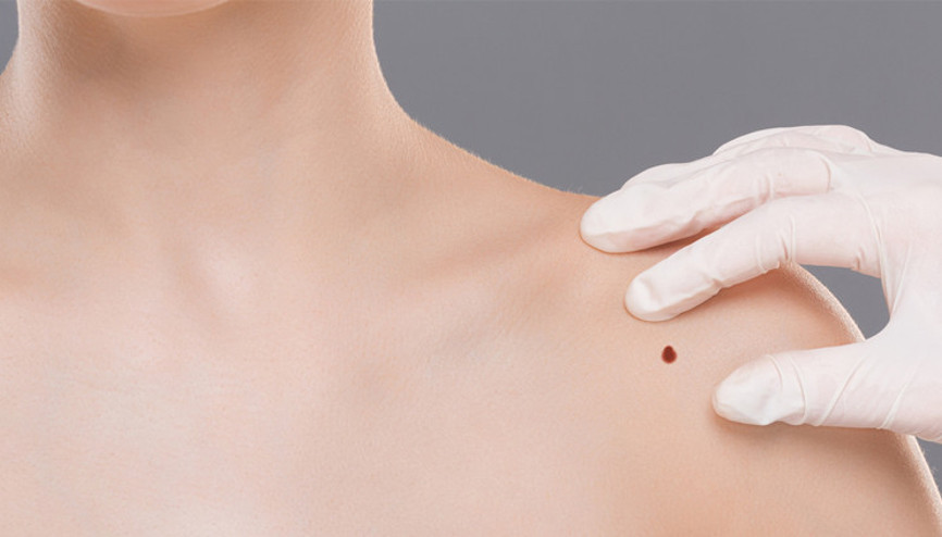 Benlere dikkat Zararsız gibi görünse de takip edilmeli