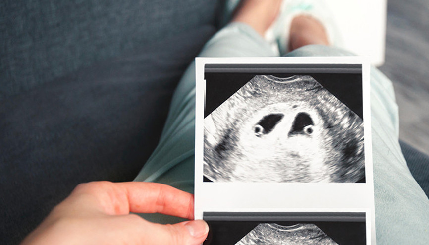 İkiz bebekle ilgili bilinen yanlışlar anne adayını zorlayabilir