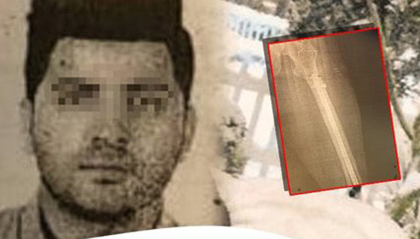 Son dakika haberleri... X-ray sinyal verince ortaya çıktı Gerçeği öğrenince şoka girdi
