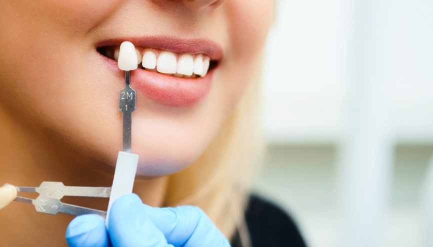 Zirkonyum Diş Kaplamaları