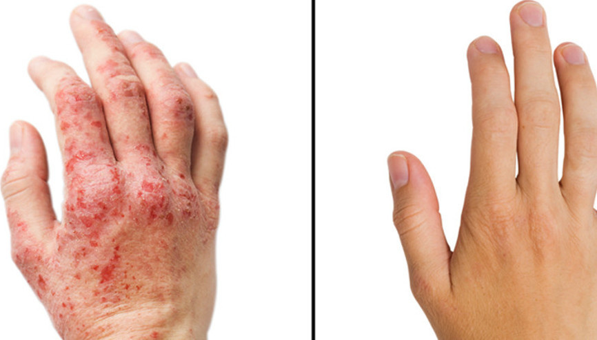 Uzmanlardan eldiven uyarısı… Koronavirüsten korunayım derken aman dikkat