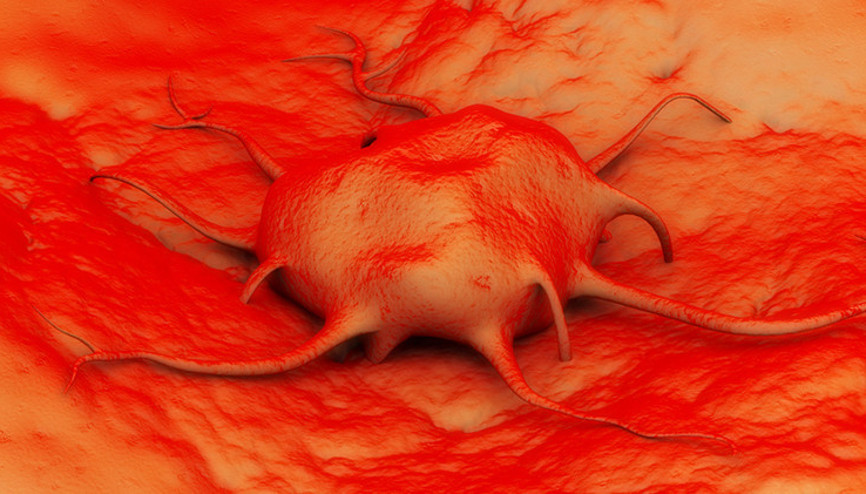 Diyet Yapmadan Verilen Kilolar Kanser Belirtisi Olabiliyor Diyet Yapmadan Verilen Kilolar Kanser Belirtisi Olabiliyor