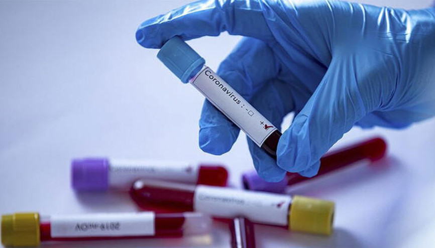 Covid 19 test sonucu nasıl öğrenilir E nabız giriş ile koronavirüs test sonucu sorgulama