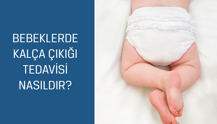 Ortopedi ve Travmatoloji Uzmanı Op. Dr. Ozan Ali Erdal cevaplıyor; Bebeklerde kalça çıkığı tedavisi nasıldır