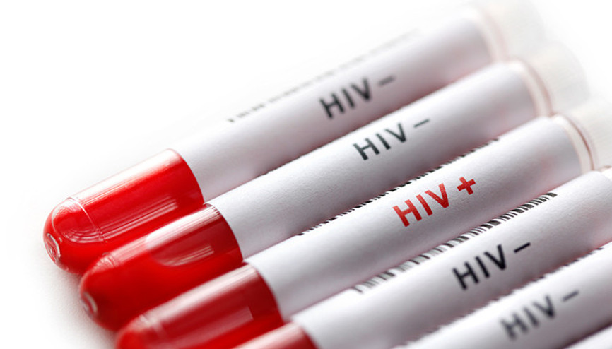 AIDS hayatımızın içinde... Korunmak için neler yapılabilir