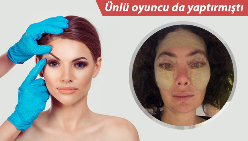 Kaş Kaldırma Estetiği Nedir, Kimlere Yapılabilir Kaş Kaldırma Estetiği Nedir, Kimlere Yapılabilir