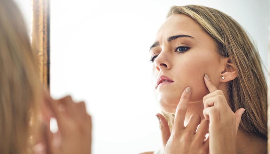 Akne oluşumunun nedenlerinden biri de stres