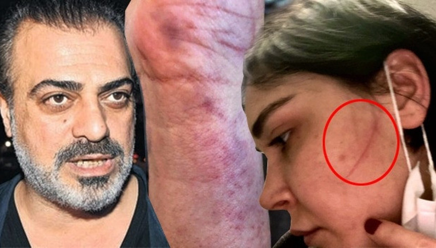 Görüntüler ortaya çıktı
