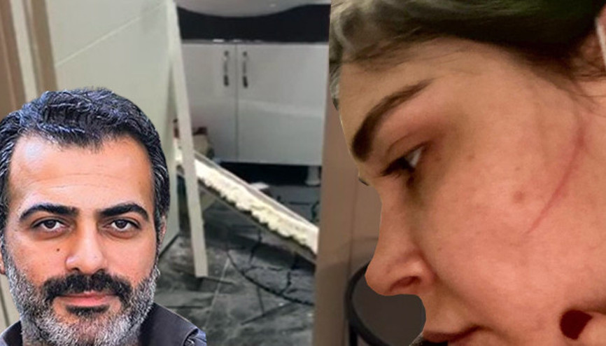 Son dakika haberler... Sevcan Yaşar, Sermiyan Midyatın kendisini darp ettiğini iddia etmişti.. Bu görüntüler paylaşıldı..