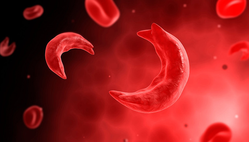 Kansızlık vücudu baştan aşağı etkiliyor