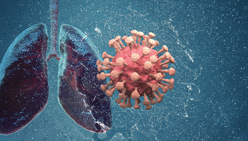 Zatürre sağlıklı kişileri de etkileyebiliyor