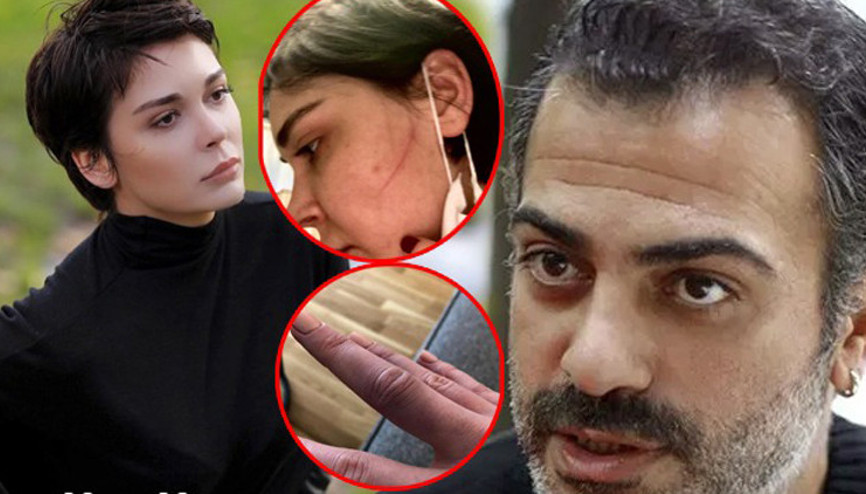 Son dakika haberler.. Sevcan Yaşar: Sermiyan Midyat dövüp çıplak videomu çekti.. Beni kendi evimden attı