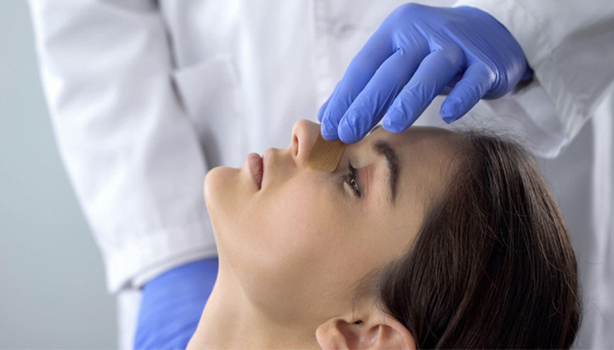 Burun Estetiği Sonrası Nelere Dikkat Edilmeli