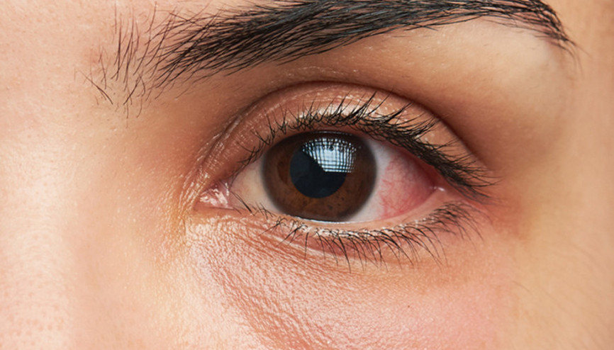 Soğuk havaların vücudunuza şaşırtıcı etkileri olabilir