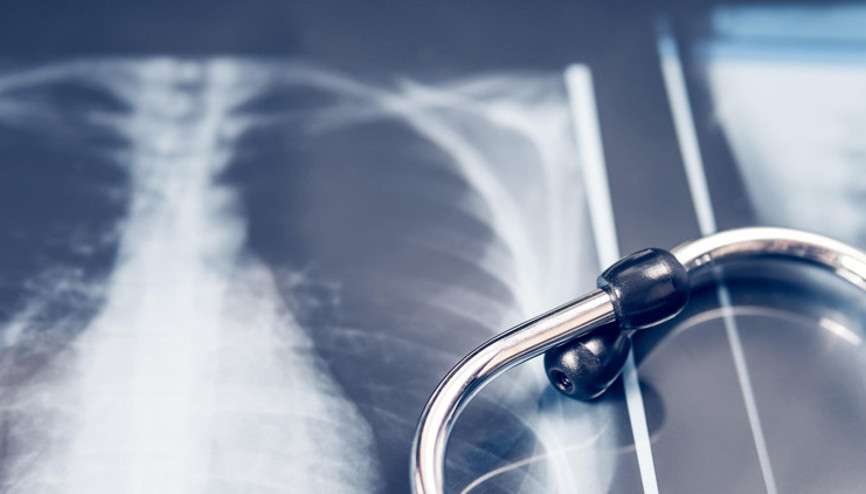 Akciğer sağlığını korumak genel vücut sağlığı için çok önemli