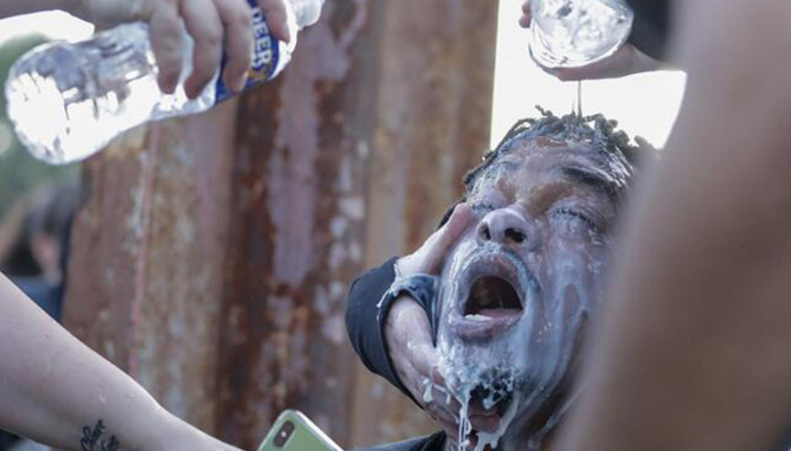 Son dakika...ABDden çarpıcı araştırma: Siyahilere uygulanan şiddet 16 kat fazla Son dakika...ABDden çarpıcı araştırma: Siyahilere uygulanan şiddet 16 kat fazla