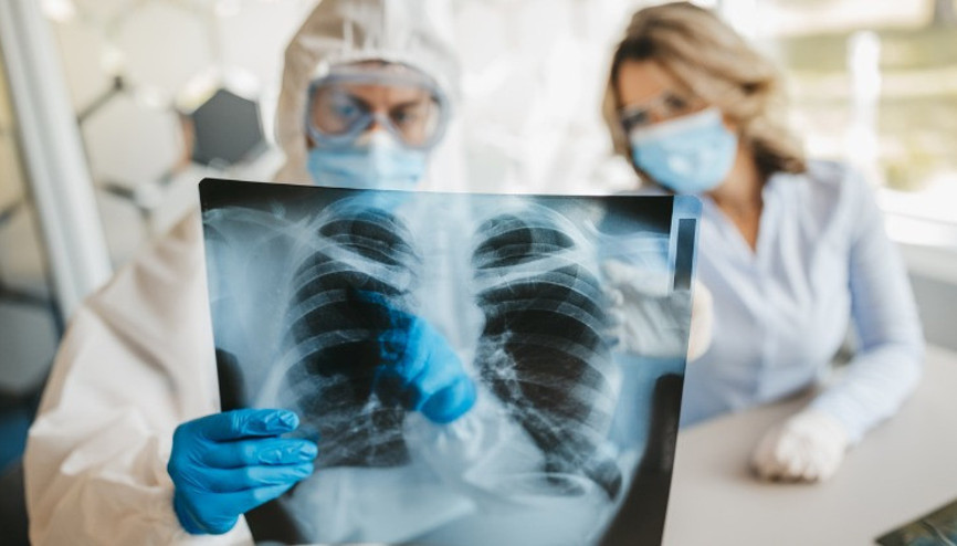 Akciğer Hasarı Kök Hücre ile Tedavi Edilebilir mi