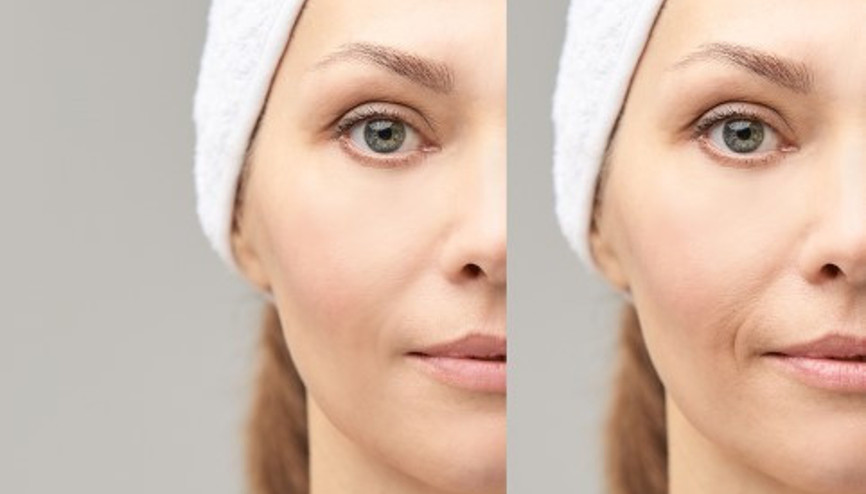 Kış Aylarında Çıkan 5 Cilt Hastalığı ve Korunma Yolları Kış Aylarında Çıkan 5 Cilt Hastalığı ve Korunma Yolları