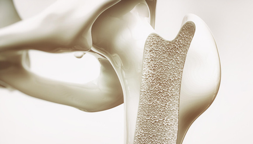 Güçlü kemiklerin sırrı Bu vitamin ve minerallerle dost olun