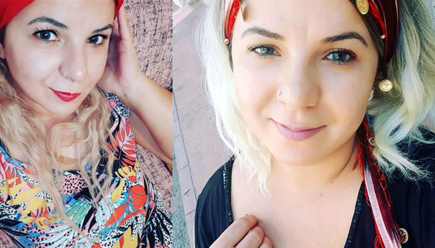 Yanlış ilaç kullanımı yüzünden tanınmaz hale gelmişti, başına gelenler dünya basınına yansıdı