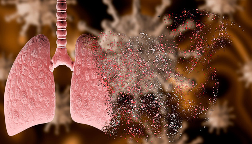 Covid-19 salgını verem hastalığı ile savaşı olumsuz etkiledi