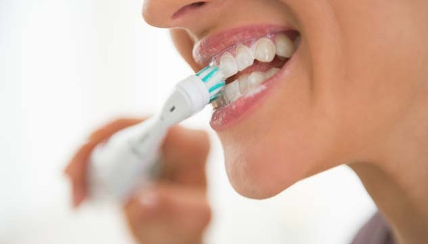 Diş Beyazlatma (Bleaching) İşlemi Nasıl Yapılır