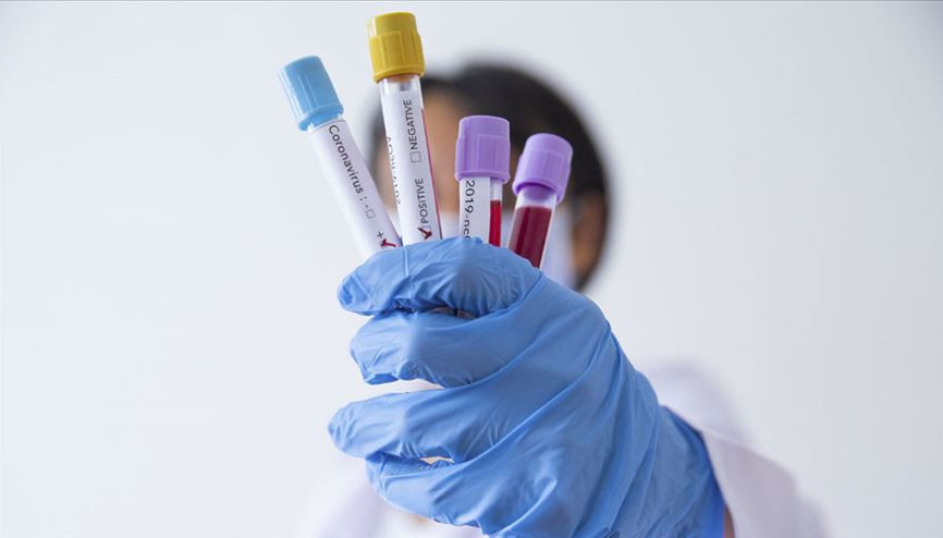 ABDden flaş karar 26 Ocaktan itibaren geçerli olacak