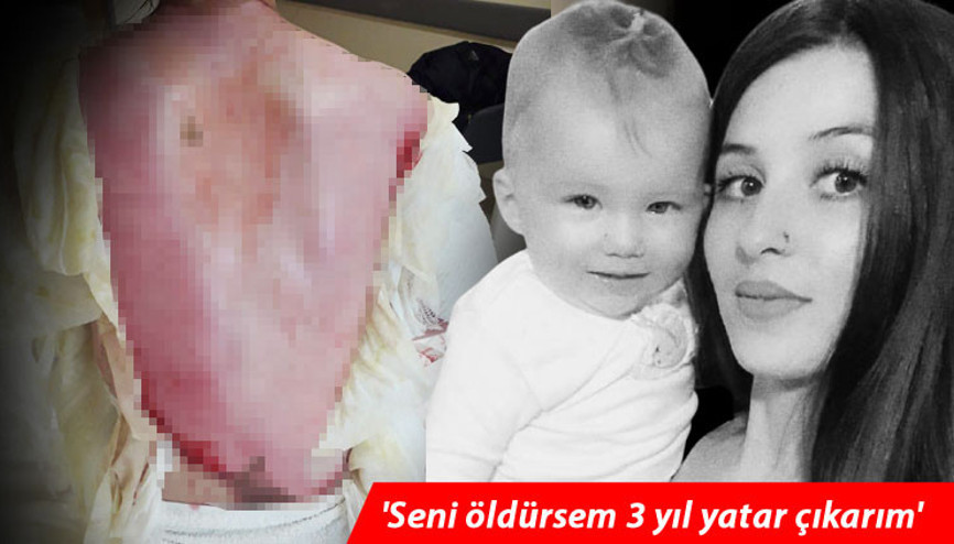 Bu nasıl dehşet 1,5 yaşındaki kızı ve eşinin üzerine kaynar su döktü, serbest bırakıldı
