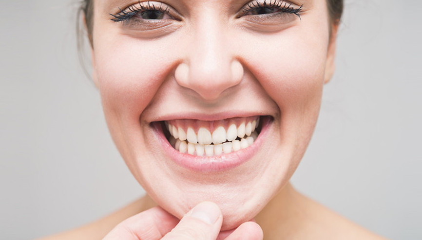 Gülüşünüz Eksik Olmasın