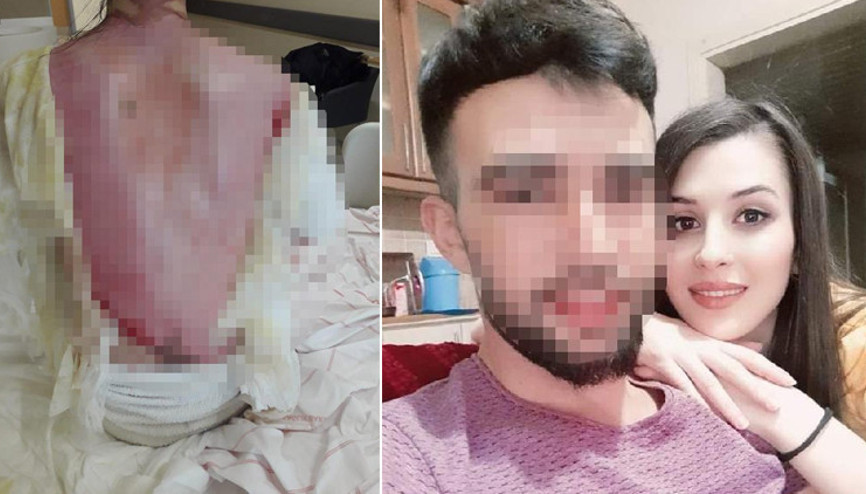 Eşini ve 1,5 yaşındaki kızını haşladı: Kazara oldu