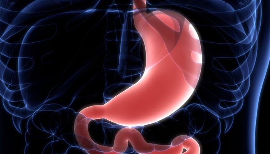 Dumping sendromu nedir, neden olur