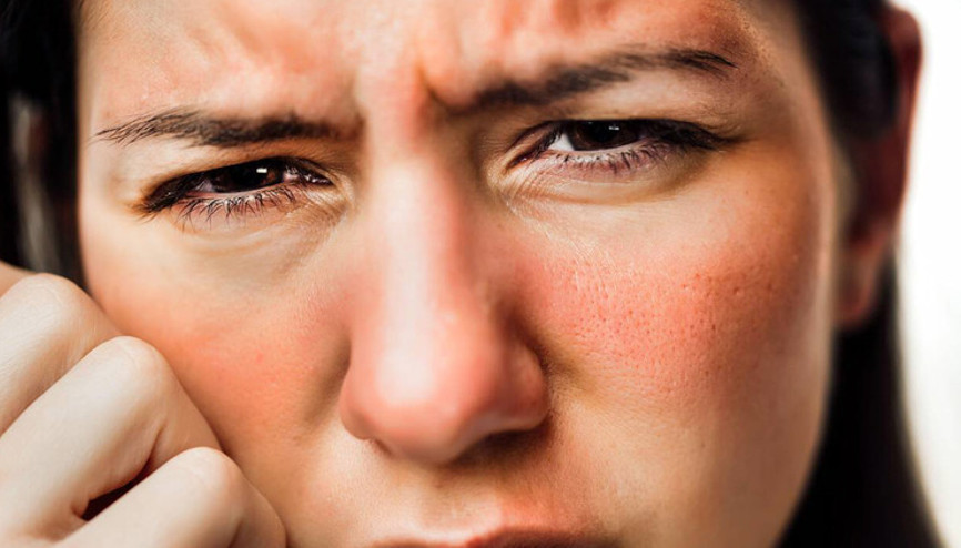 Lupus hastalığı nedir, neden olur Lupus hastalığı belirtileri, tedavisi…