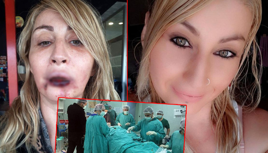 Estetik ameliyat sonrası dudağı çürümüştü Songül Uzunoğlu doğal görünümüne kavuşacak