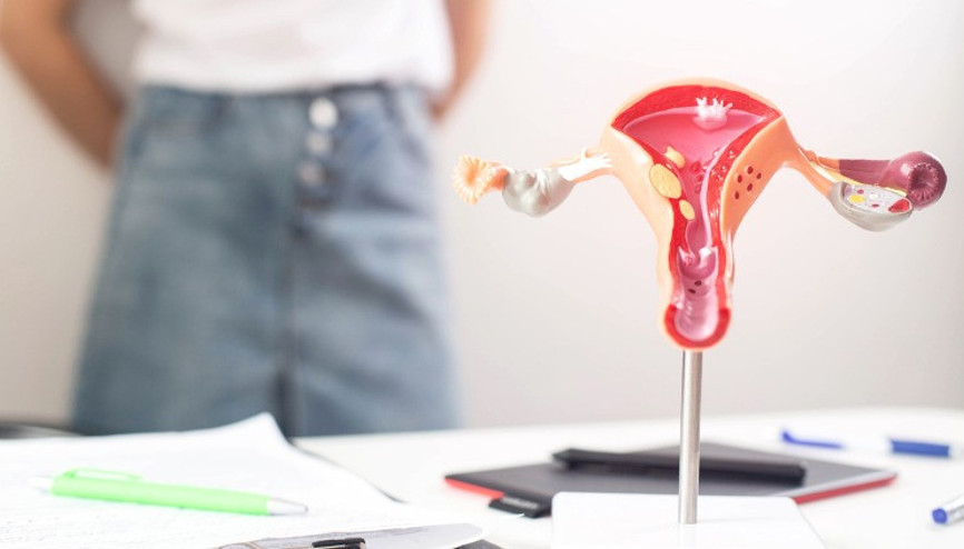 Polikistik Over Sendromu Nedir Tanı Nasıl Konulur Polikistik Over Sendromu Nedir Tanı Nasıl Konulur