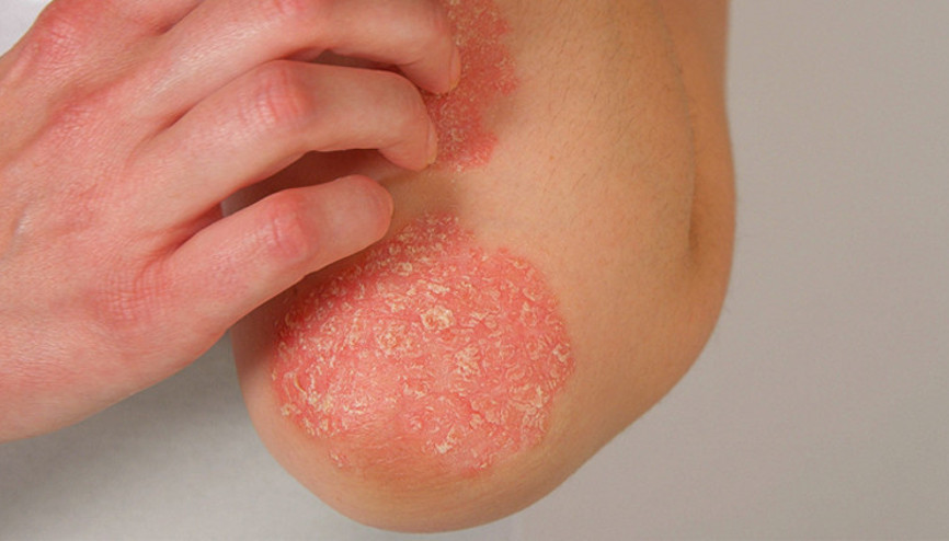 Egzamaya dikkat Kış aylarında risk iki kat artıyor