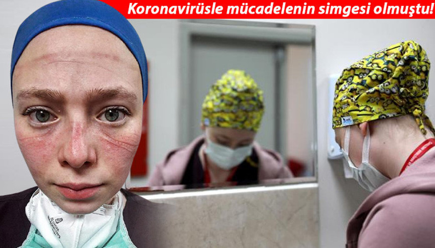 Koronavirüsle mücadelenin simgesi olmuştu Seher Altuncunun anlattıkları gözyaşlarına boğdu