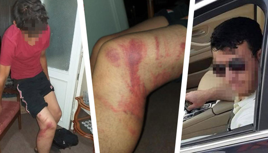 Triger kayışı silah sayıldı Çırağını döven ustaya 2 yıl hapis