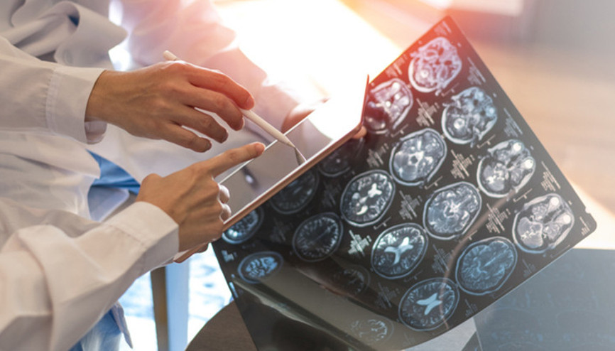 Kadınlarda daha sık görülüyor… MS belirtileri neler, nasıl tedavi edilir