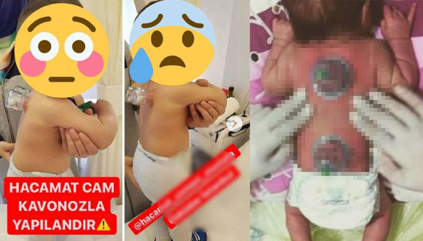 Sosyal medyadaki görüntüler tepki çekmişti Uyarı geldi...