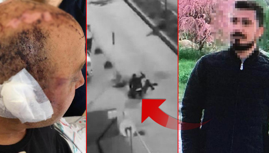 Eskişehirde polis memurunu telsizle dövmüştü Yeni gelişme