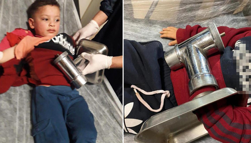 Kahreden olay 3 yaşındaki Ahmet, elini kıyma makinesine kaptırdı Kahreden olay 3 yaşındaki Ahmet, elini kıyma makinesine kaptırdı