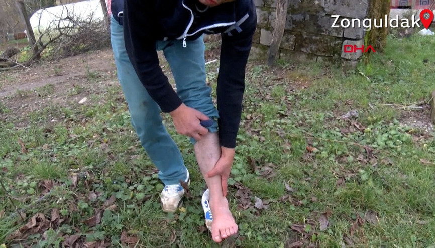 Bel ağrısı şikayetiyle gittiği hastanede yapılan iğne hayatını kararttı Bel ağrısı şikayetiyle gittiği hastanede yapılan iğne hayatını kararttı